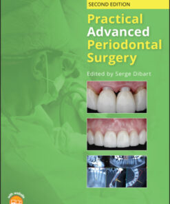 Practical Advanced Periodontal Surgery 2nd Edition - Original PDF