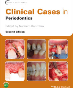 Clinical Cases in Periodontics 2nd Edition - Original PDF