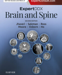ExpertDDx: Brain and Spine 2nd Edition - Original PDF
