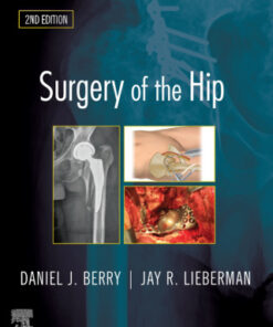 Surgery of the Hip 2e 2nd Edition - Original PDF