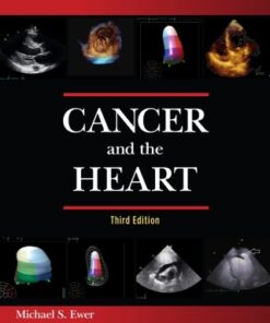 Cancer and the Heart 3rd Edition (Instant Download) - Original PDF