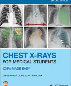 Chest X-Rays for Medical Students 2nd Edition - Original PDF