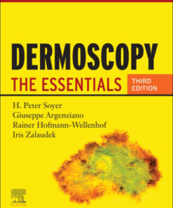 Dermoscopy: The Essentials 3rd Edition - Original PDF