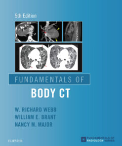 Fundamentals of Body CT 5th Edition - Original PDF