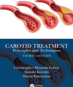 Carotid Treatment: Principles and Techniques 3rd Edition - Original PDF