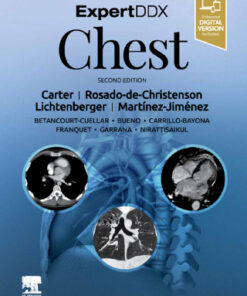 ExpertDDx: Chest 2e 2nd Edition - Original PDF