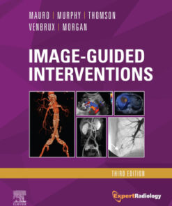 Image-Guided Interventions, Expert Radiology Series 3rd Edition - Original PDF