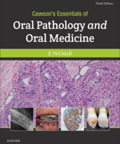 Cawson's Essentials of Oral Pathology and Oral Medicine 9th Edition - Original PDF