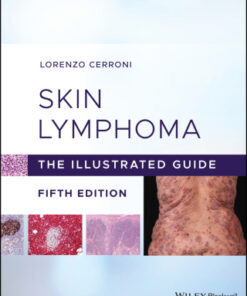 Skin Lymphoma: The Illustrated Guide 5th Edition - Original PDF