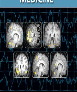 Sleep and Psychosomatic Medicine 2nd Edition - Original PDF