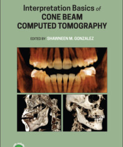 Interpretation Basics of Cone Beam Computed Tomography 2nd Edition - Original PDF