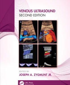 Venous Ultrasound 2nd Edition (Instant Download) - Original PDF