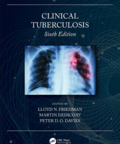 (Instant Download) Clinical Tuberculosis 6th Edition - Original PDF