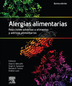 Alergias alimentarias. Reacciones adversas a alimentos y aditivos alimentarios 5th Edition - Original PDF