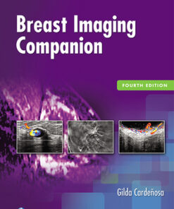 Breast Imaging Companion 4th Edition by Gilda Cardenosa - Original PDF