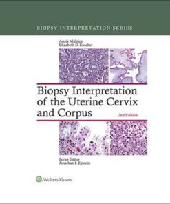 Biopsy Interpretation of the Uterine Cervix and Corpus 2nd Edition by Anais Malpica - Original PDF
