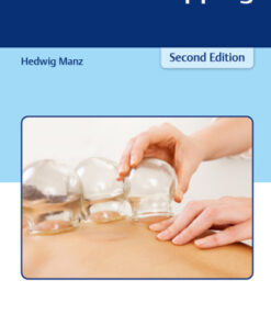 The Art of Cupping 2nd Edition - Original PDF