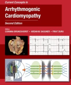 Current Concepts in Arrhythmogenic Cardiomyopathy 2nd Edition - Original PDF