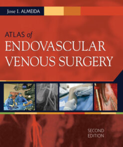 Atlas of Endovascular Venous Surgery, Expert Consult 2nd Edition - Original PDF