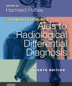 Chapman & Nakielny's Aids to Radiological Differential Diagnosis 7th Edition - Original PDF