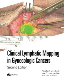 Clinical Lymphatic Mapping in Gynecologic Cancers 2nd Edition - Original PDF