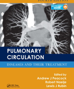 Pulmonary Circulation: Diseases and Their Treatment 4th Edition - Original PDF