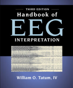 Handbook of EEG Interpretation 3rd Edition - Original PDF