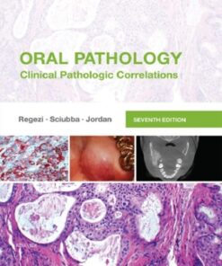 Oral Pathology: Clinical Pathologic Correlations 7e 7th Edition - Original PDF