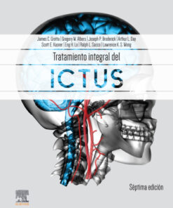 Tratamiento integral del ictus 7th Edition - Original PDF