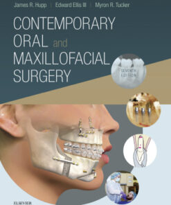 Contemporary Oral and Maxillofacial Surgery 7th Edition - Original PDF
