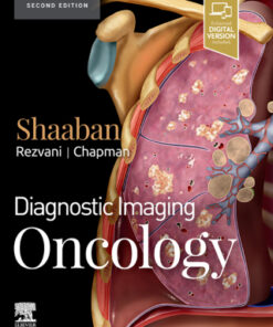 Diagnostic Imaging: Oncology 2nd Edition by Akram M. Shaaban - Original PDF