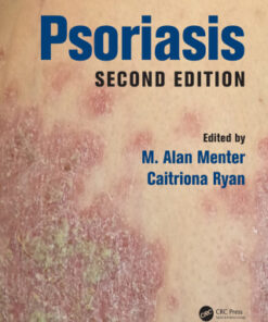 Psoriasis 2nd Edition - Original PDF