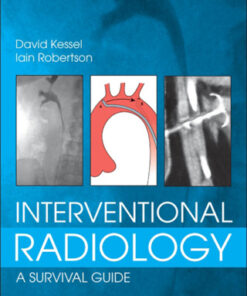 Interventional Radiology: A Survival Guide 4th Edition - Original PDF