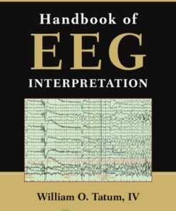 Handbook of EEG Interpretation 2e 2nd Edition - Original PDF
