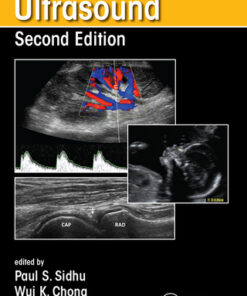 (Instant Download) Measurement in Ultrasound 2nd Edition - Original PDF