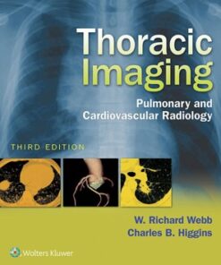 Thoracic Imaging: Pulmonary and Cardiovascular Radiology 3rd Edition - Original PDF