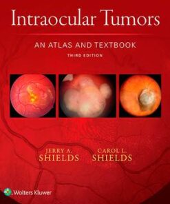 Intraocular Tumors: An Atlas and Textbook 3rd Edition by Jerry A. Shields - Original PDF