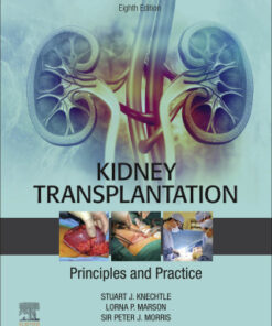 Kidney Transplantation - Principles and Practice 8th Edition - Original PDF