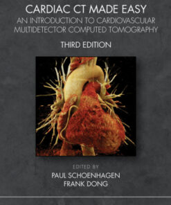 Cardiac CT Made Easy, An Introduction to Cardiovascular Multidetector Computed Tomography 3rd Edition - Original PDF