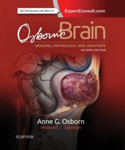 Osborn's Brain 2nd Edition - Original PDF
