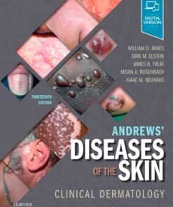 Andrews' Diseases of the Skin: Clinical Dermatology 13th Edition - Original PDF