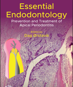 Essential Endodontology, Prevention and Treatment of Apical Periodontitis 3rd Edition - Original PDF