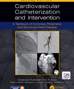 Cardiovascular Catheterization and Intervention, A Textbook of Coronary, Peripheral, and Structural Heart Disease,  2nd Edition (Instant Download) - Original PDF