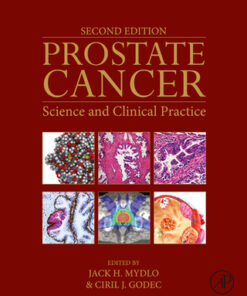 Prostate Cancer 2nd Edition by Jack H. Mydlo - Original PDF