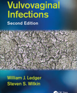 Vulvovaginal Infections 2e 2nd Edition - Original PDF