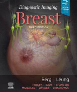 Diagnostic Imaging: Breast 3rd Edition by Wendie A. Berg - Original PDF