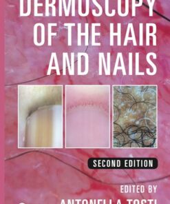 Dermoscopy of the Hair and Nails 2nd Edition - Original PDF