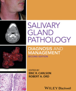 Salivary Gland Pathology: Diagnosis and Management 2nd Edition - Original PDF