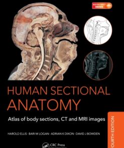 Human Sectional Anatomy: Atlas of Body Sections, CT and MRI Images 4th Edition - Original PDF